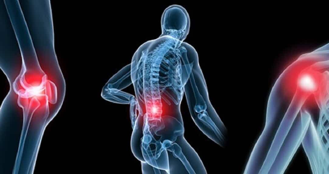 Arthrose, arthrite : quelles sont les différences ?