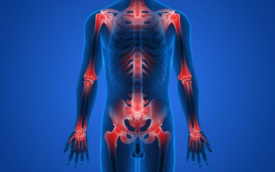 Arthrose : dossier complet